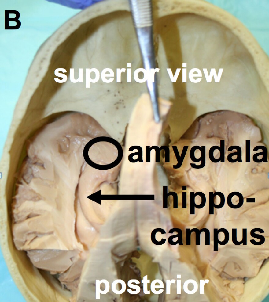 the hippocampal formation